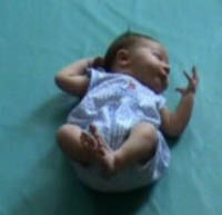 Will 6 days supine 11.jpg