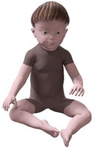 Hypermobile-infant-ring-sitting.jpg