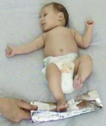 Will 7w supine foil under feet.jpg